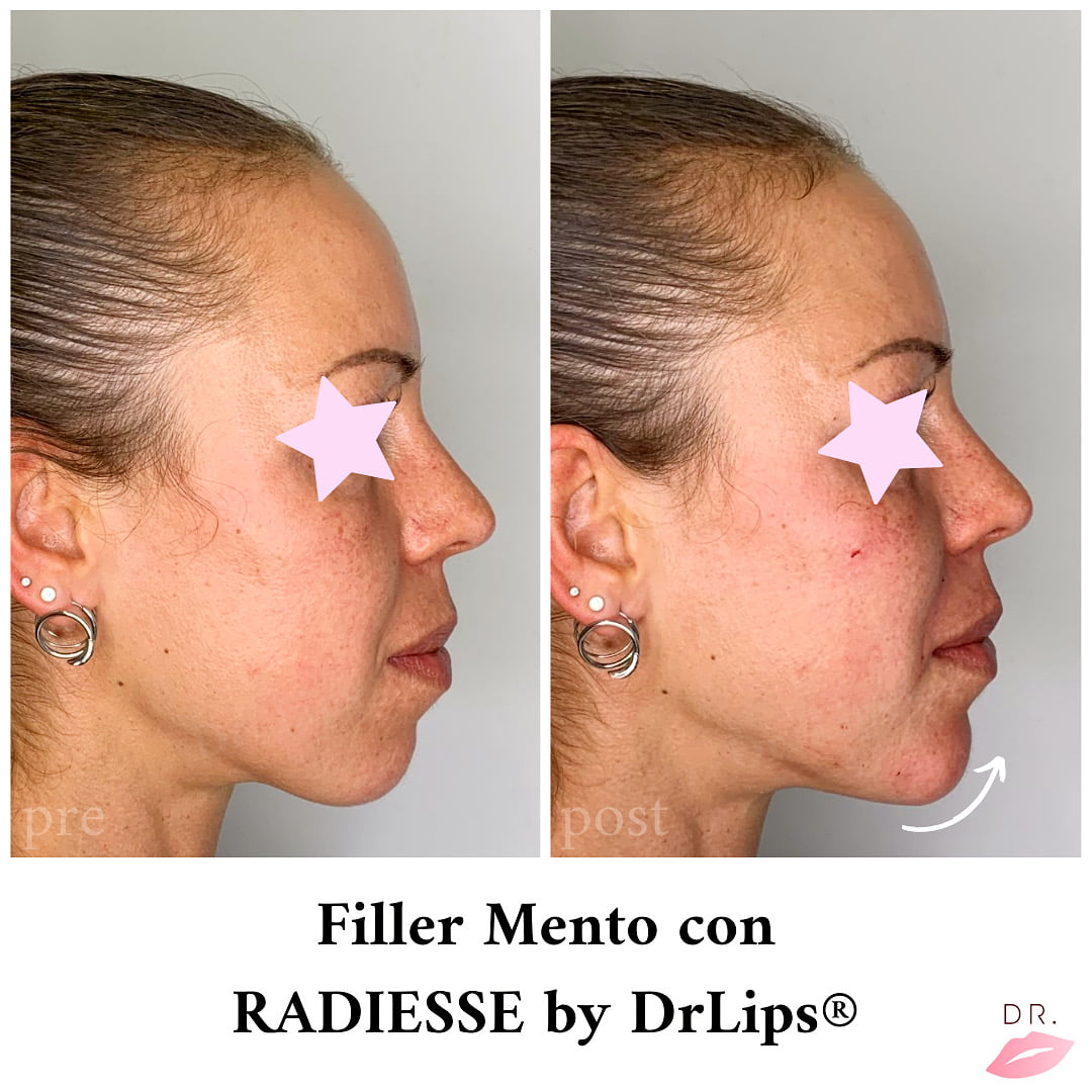 face-contouring-drlips (1)